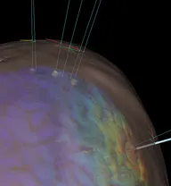 nARvibrain